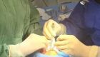 Prefeitura de Búzios realiza mais um mutirão de cirurgias plásticas no Hospital Rodolpho Perissé