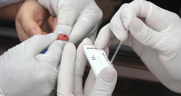 Primeiro dia de testes em Búzios detecta 36 pessoas infectadas com novo coronavírus