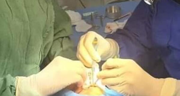 Prefeitura de Búzios realiza mais um mutirão de cirurgias plásticas no Hospital Rodolpho Perissé