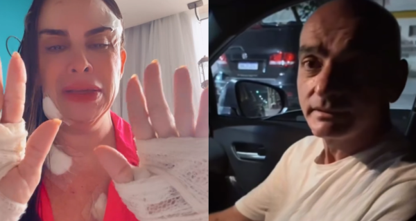 Vítima de tentativa de feminicídio, empresária de Cabo Frio recebe alta