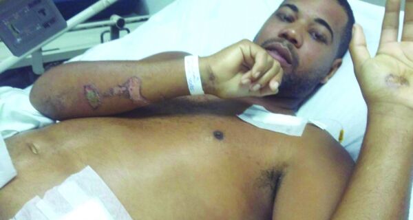 Motociclista atropelado em Cabo Frio já passou por 7 cirurgias