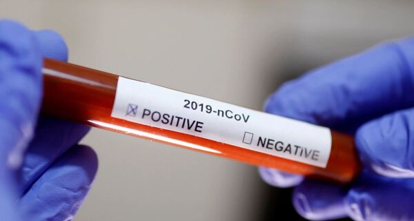 Quinta morte pelo novo coronavírus é registrada em Macaé
