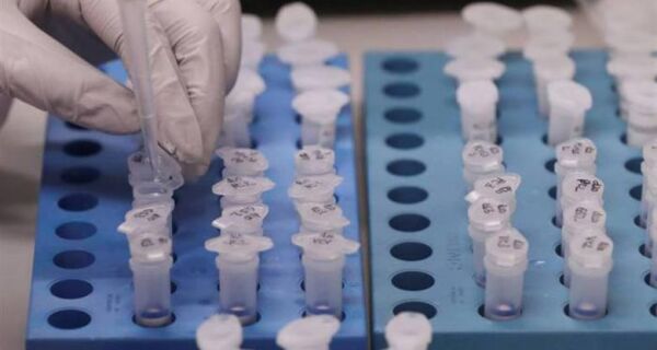 Brasil vai testar potencial vacina contra Covid-19 produzida em Oxford