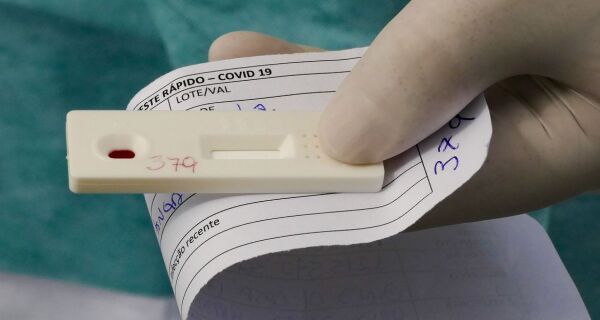Portaria do Ministério da Saúde torna obrigatória notificação de resultados de testes da Covid-19